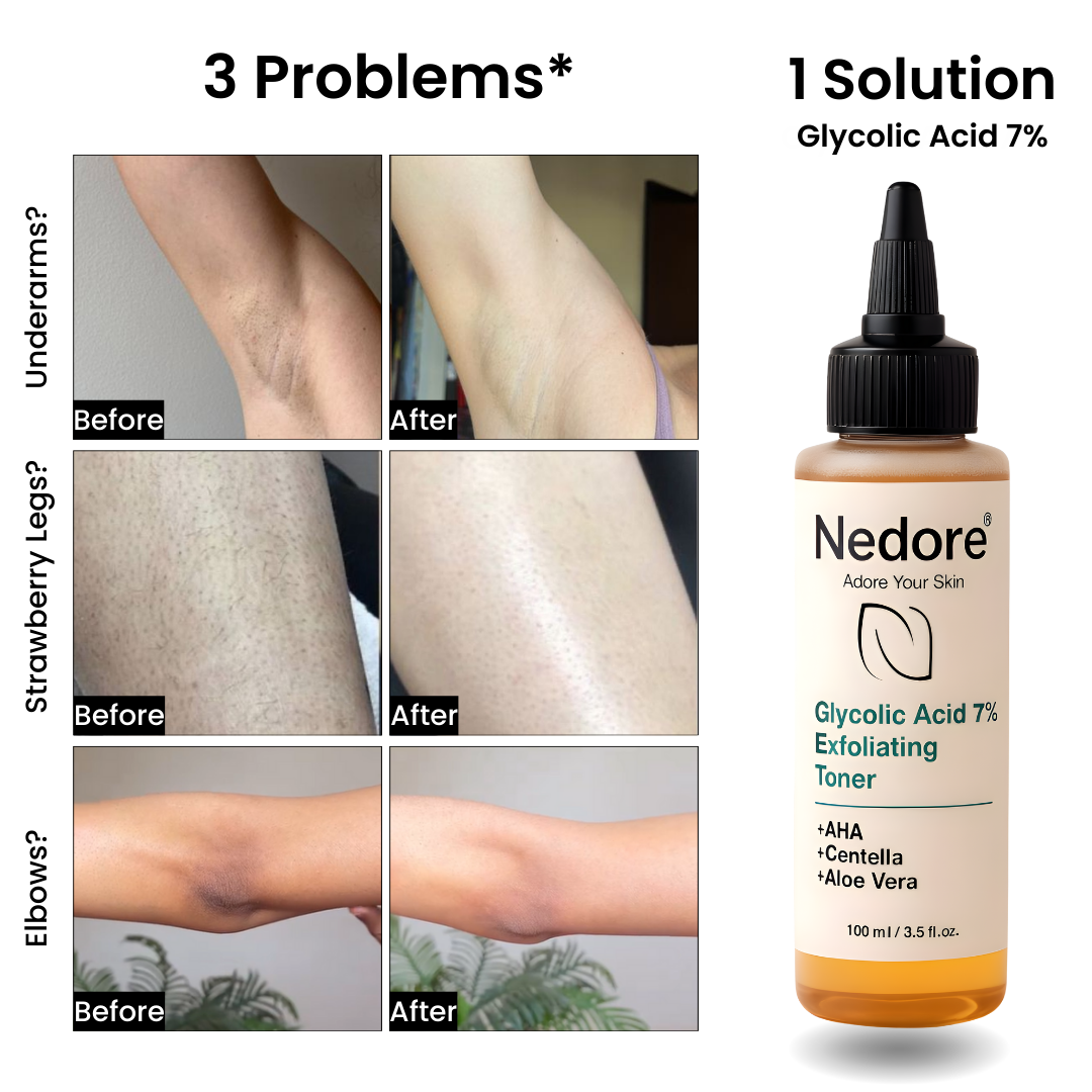 Glycolic Acid 7% Exfoliating Toning Solution
