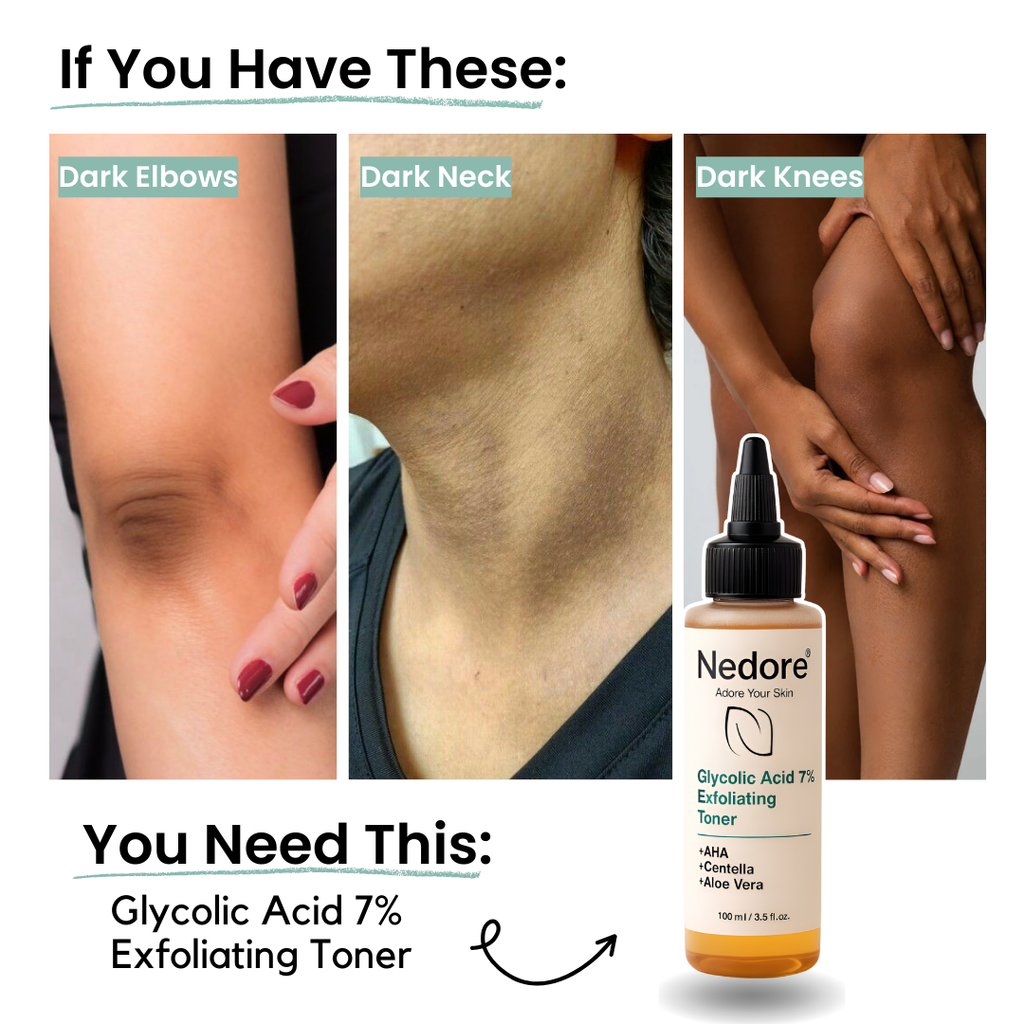 Glycolic Acid 7% Exfoliating Toning Solution